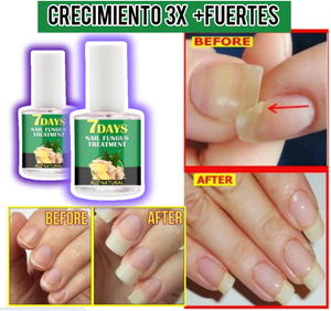 Endurecedor de uñas 4K potente crecimiento & hongos0(COMPRA 1 Y LLEVAS 3 EN TOTAL)⭐⭐⭐⭐⭐,‼️(ENVIO GRATIS 🔥)PAGO CONTRA ENTREGA🚛. - mega-store-colombi