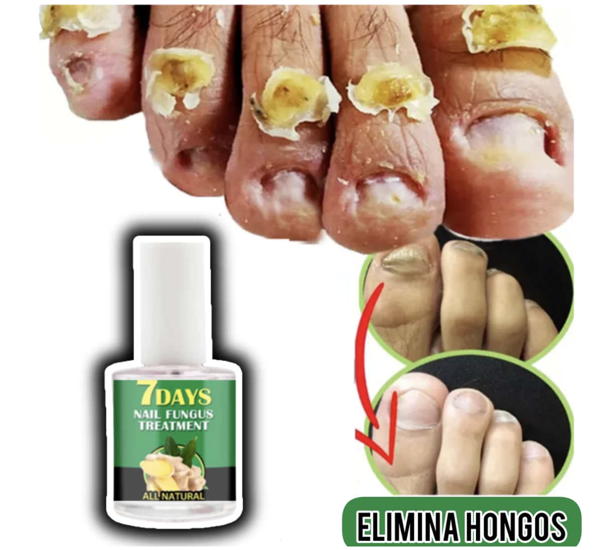 Endurecedor de uñas 4K uñas potente crecimiento & hongos1(COMPRA 1 YLLEVAS 3 EN TOTAL) ⭐⭐⭐⭐⭐,‼️(ENVIO GRATIS 🔥)PAGO CONTRA ENTREGA🚛. - mega-store-colombi