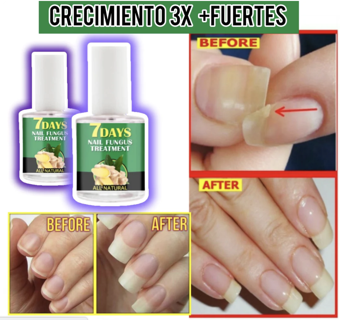 Endurecedor de uñas 4K   potente crecimiento & hongos0(COMPRA 1 Y LLEVAS 3 EN TOTAL)⭐⭐⭐⭐⭐,‼️(ENVIO GRATIS 🔥)PAGO CONTRA ENTREGA🚛. - mega-store-colombi